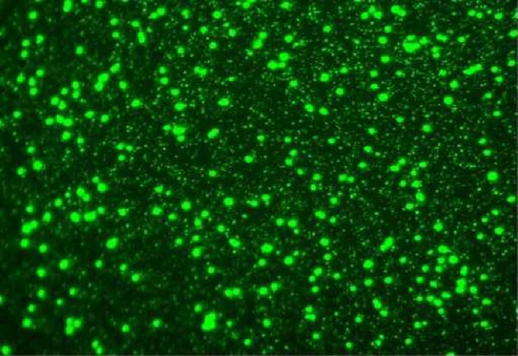 Stained seawater under epifluorescence, SYBR Green dye; larger green dots are bacterial cells, smaller faint points are virus particles.