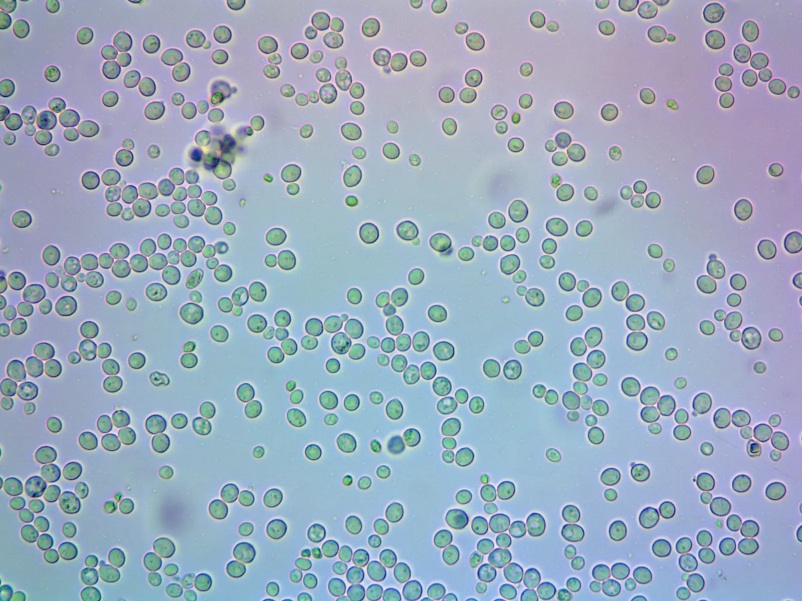 Compressed baker's yeast cells; cells of one lab strain run 3.6–11.0 µm; light micrograph, no stain stated; round cells, a few with small buds.
