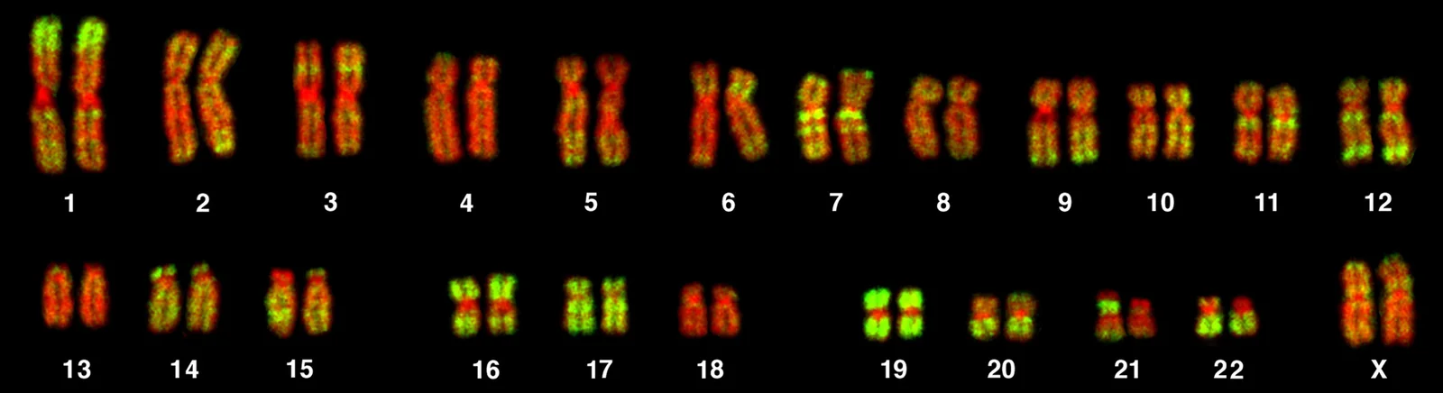 Human chromosomes, the largest about 8–10 µm long, fluorescence micrograph; red DNA counterstain with green Alu probe signals, pairs 1–22 and X.
