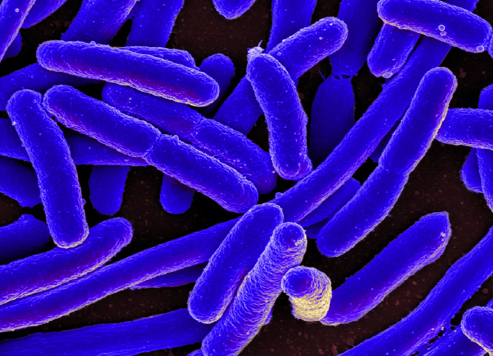 Escherichia coli, rods averaging 1.0–1.5 µm wide in one culture study, scanning electron micrograph colored afterwards; violet-blue on dark brown.