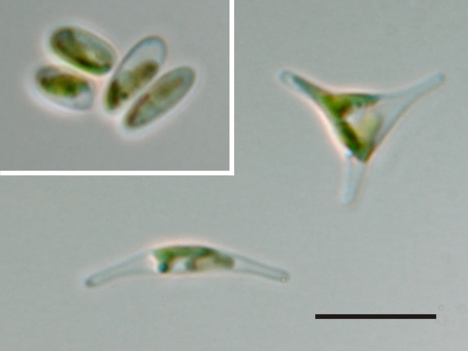 Phaeodactylum tricornutum in three forms beside a 10 µm scale bar; light micrograph, no stain stated; one cell has three arms.