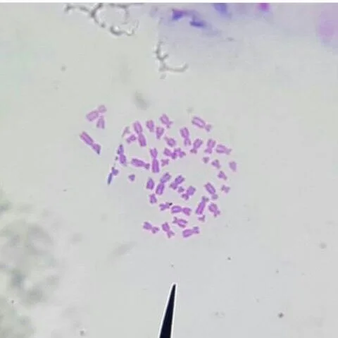 Female human chromosomes at metaphase, the largest about 8–10 µm long, light micrograph, stained purple; a loose cluster of dozens.