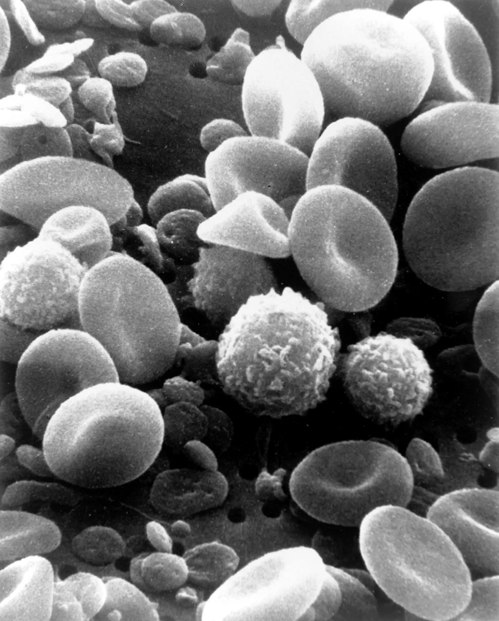 Human blood cells, red cells about 100 µm³ each, scanning electron micrograph, native grey; dimpled discs beside round, ruffled white cells.