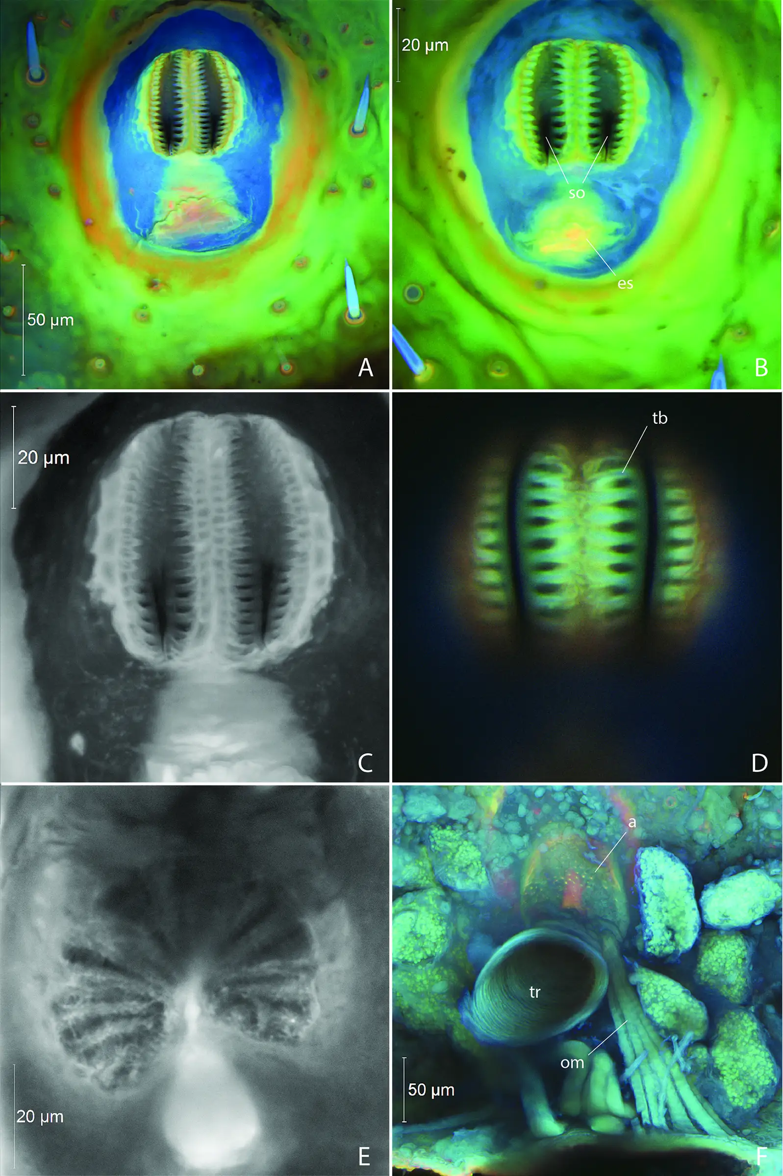 Firefly larva spiracle, opening about 48 µm long, light and confocal micrographs, cuticle autofluorescence; branched bars, a filter, a chamber.