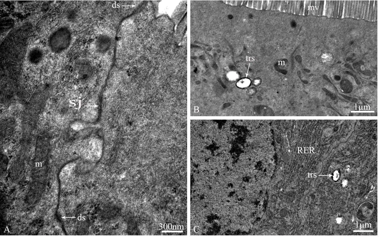 Katydid gut cells, electron micrograph, native grey; tracheoles 0.45–0.7 µm across show as pale rings edged in dark, with 1 µm scale bars.