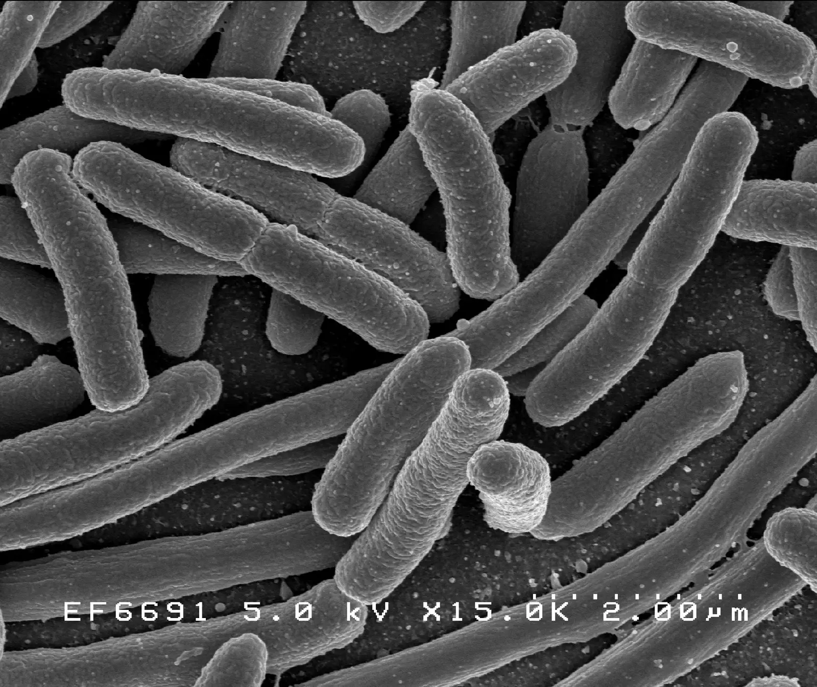 Escherichia coli cells, rods about 1 µm wide and a few µm long, scanning electron micrograph, native grey; 2.00 µm scale bar printed in the image.