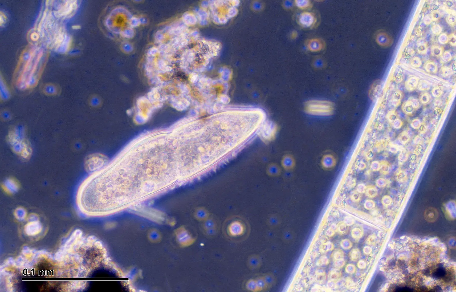 Paramecium caudatum about 0.2 mm long, twice a printed 0.1 mm bar; negative phase contrast, unstained; fine hairs along its lower edge.