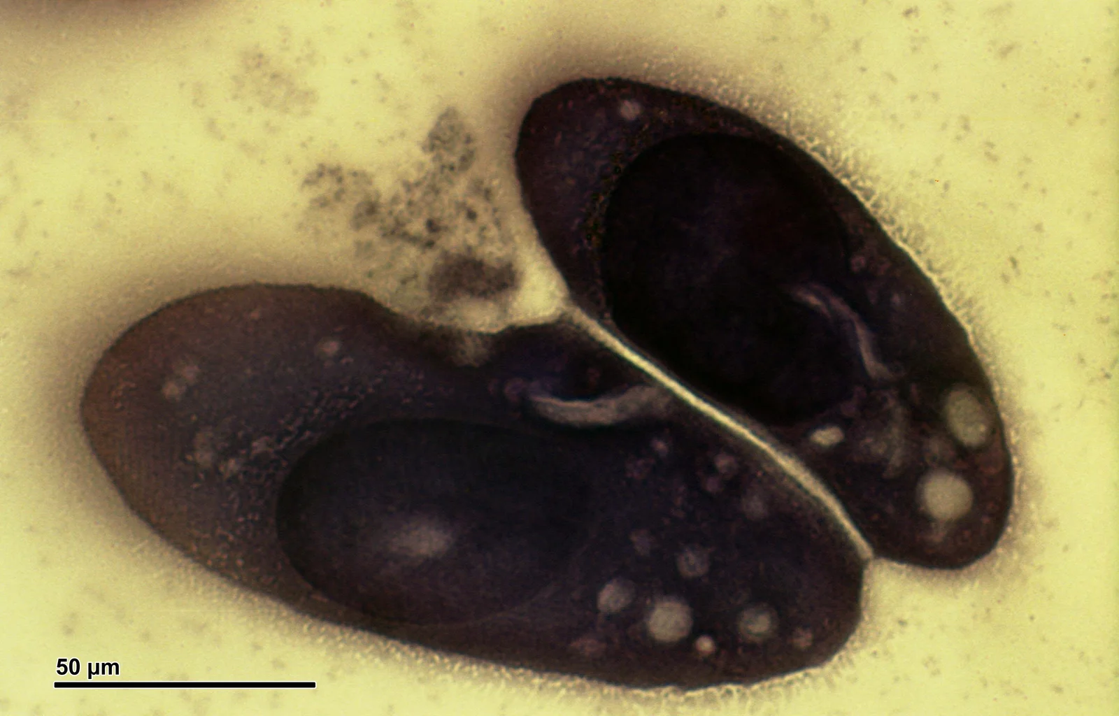 Two Paramecium caudatum cells, a species 140–311 µm long, beside a 50 µm bar; bright-field micrograph, stained dark violet; a dark oval body in each.
