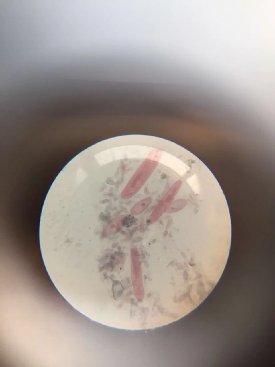 Paramecium cells, a genus mostly 50–300 µm long in one review, photographed through a microscope eyepiece, stained pink; a round field of view.