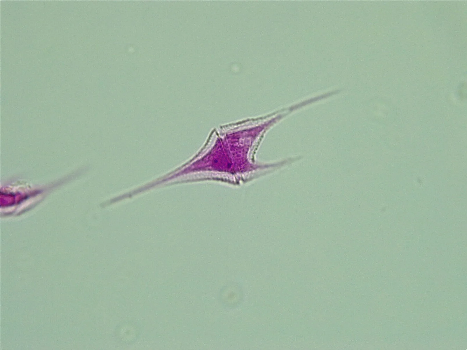 Ceratium, a dinoflagellate genus with typical sizes of about 50–400 µm in one compilation, light micrograph; a cell with long horn-like projections.
