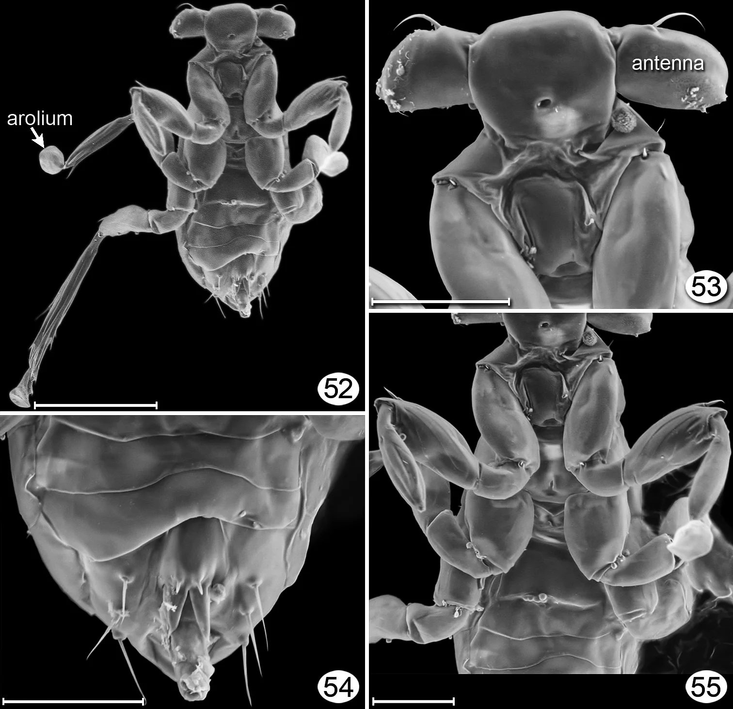 Dicopomorpha echmepterygis male, about 0.13 mm long, scanning electron micrograph, no color; no wings, stubby antennae, a round pad on one foot.