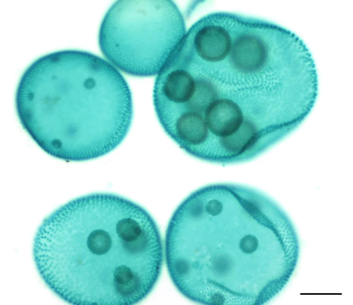Five Volvox spheres, the two whole ones 0.28 and 0.4 mm across by a 0.1 mm bar; light micrograph, color-balanced teal; darker bodies inside.