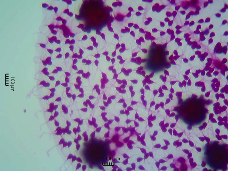 Part of a Volvox sphere; the genus's largest spheres are 0.35–0.92 mm in seven descriptions; light micrograph, stained magenta; dark round clusters.